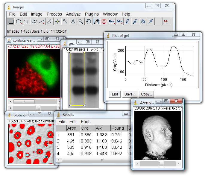 ImageJ